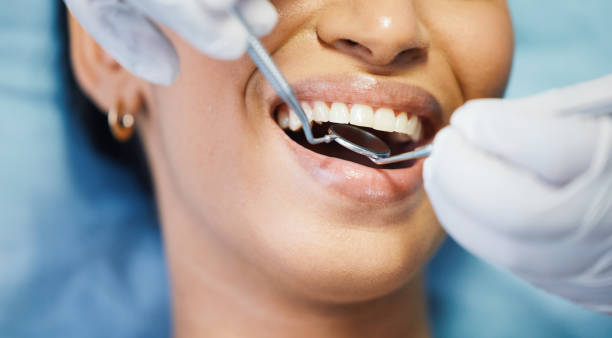 Best Emergency Dentist for Knocked-Out Tooth in Buckeye, AZ